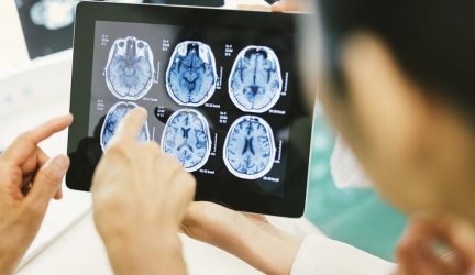 PQQ Supplements: Benefits, Dosage, Where To Buy